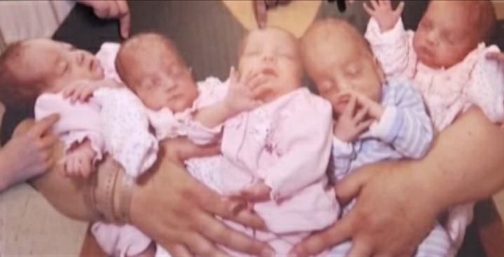 29 Year Old Mother Gives Birth To Quintuplets In Colombo Newswire